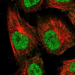 AAMDC Antibody, Novus Biologicals 25 &mu;L, Unlabeled:Antibodies, Polyclonal